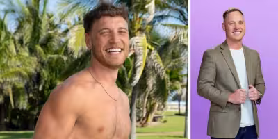 Jimmy Love Is Blind: Jimmy Presnell details hair transplant, teeth work