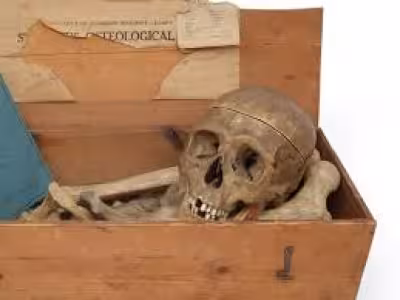 Anita Manning-linked Glasgow auction withdraws human bones lot after criticism