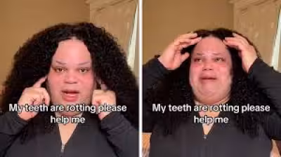 Jools Lebron cancels GoFundMe for dental costs after backlash, may leave TikTok