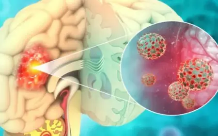 اكتشاف مذهل.. بكتيريا قد “تذيب” سرطان الرأس والعنق