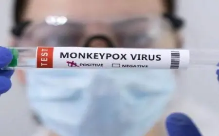 الصحة العالمية تطلق خطة تأهب واستجابة استراتيجية لاحتواء تفشي جدري القرود