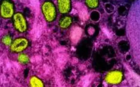 هيئة طبية: جدري القردة خارج نطاق السيطرة في أفريقيا