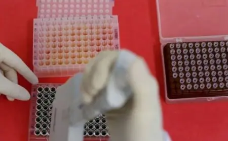 أمريكا تسجل أول إصابة بشرية شديدة بإنفلونزا الطيور