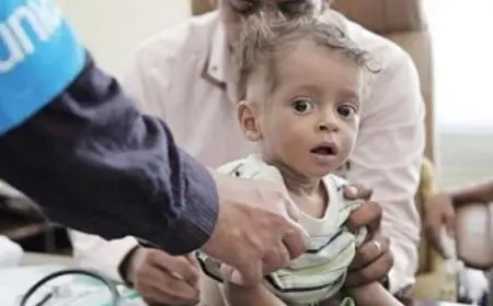 “الصحة العالمية”: اليمن يواجه أسوأ أزمة كوليرا عالمية