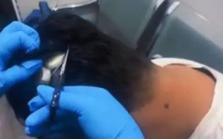 الشرطة الكولومبية تعتقل شخصا يرتدى “باروكة” مملوءة بالكوكايين