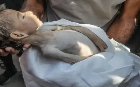 استشهاد 21 طفلا فلسطينيا بسبب سوء التغذية والمجاعة فى قطاع غزة خلال 72 ساعة