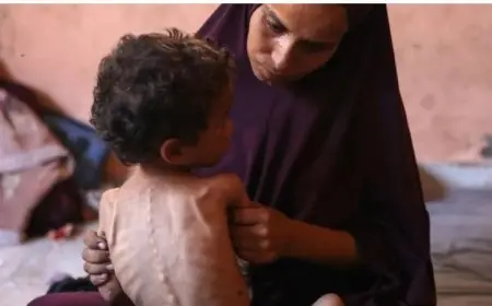 14 حالة وفاة بسبب سوء التغذية والمجاعة في قطاع غزة خلال 24 ساعة