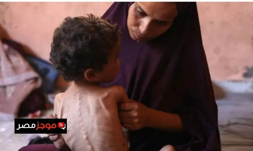 14 حالة وفاة بسبب سوء التغذية والمجاعة في قطاع غزة خلال 24 ساعة