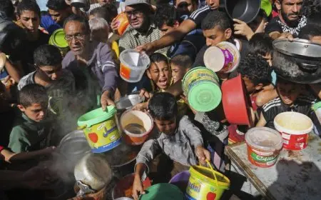 الأمم المتحدة: سوء التغذية الحاد بين الأطفال بغزة وصل أعلى مستوى