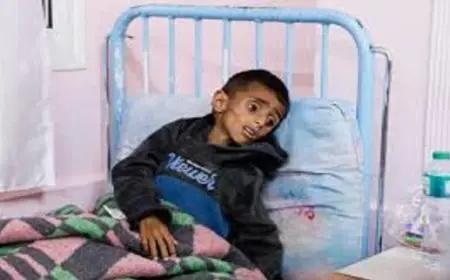 بريطانيا تتعاون مع الصحة العالمية لإجلاء أطفال غزة في ظل تدهور النظام الصحي