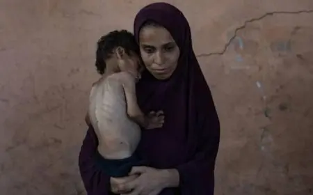 تسجل غزة 8 حالات وفاة جديدة نتيجة المجاعة وسوء التغذية خلال 24 ساعة