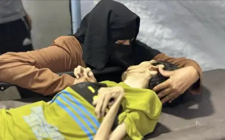 مأساة في غزة وفاة 7 فلسطينيين بسبب التجويع وسوء التغذية