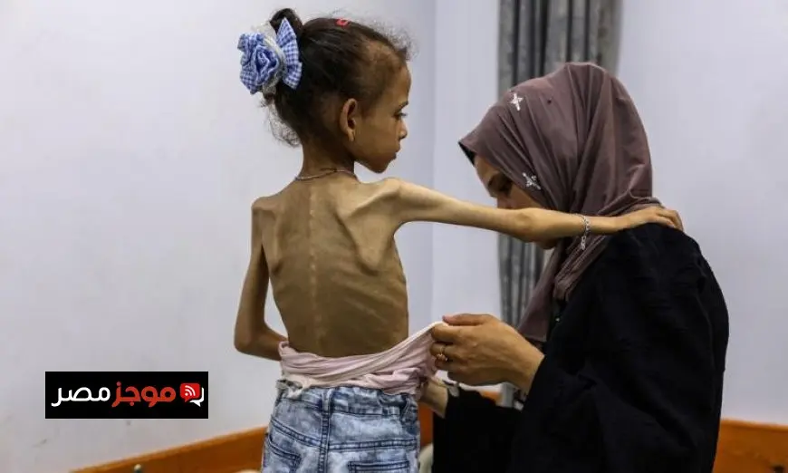 الأمم المتحدة تحذر من تدهور الأوضاع في غزة بسبب القتل المستمر وسوء التغذية