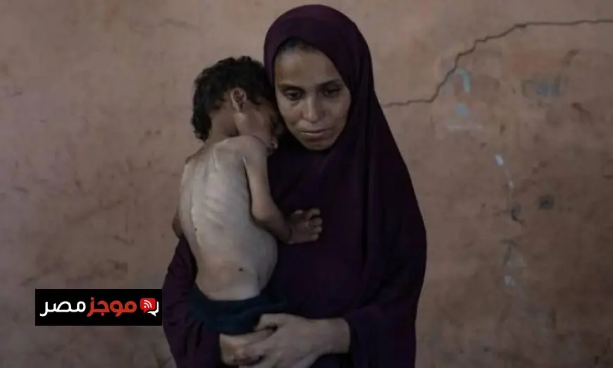 تسجل غزة 8 حالات وفاة جديدة نتيجة المجاعة وسوء التغذية خلال 24 ساعة