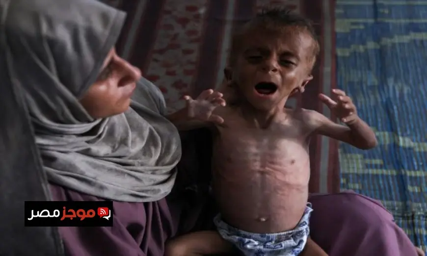 مصادر طبية في غزة تكشف عن 11 حالة وفاة بينهم طفلان نتيجة المجاعة وسوء التغذية خلال يوم واحد