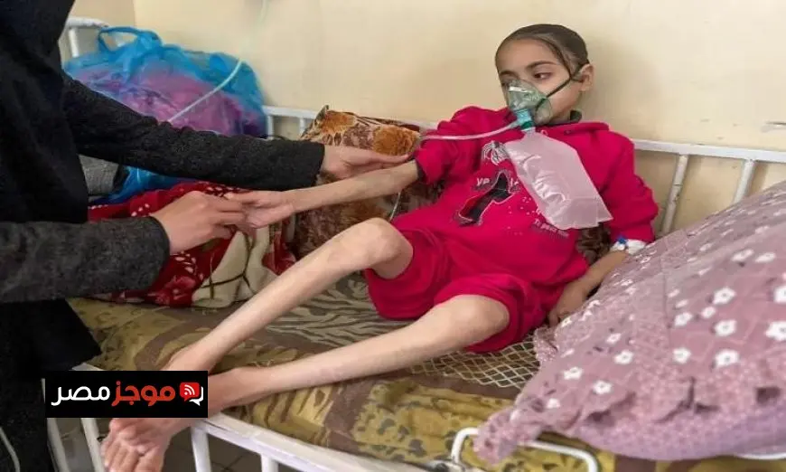 استشهاد ثلاثة فلسطينيين جراء المجاعة وسوء التغذية في قطاع غزة