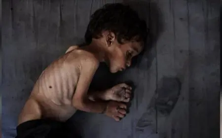 مأساة إنسانية وفاة 5 فلسطينيين من بينهم 3 أطفال بسبب المجاعة في 24 ساعة