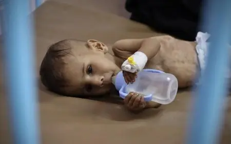 معدل سوء التغذية بين الأطفال في غزة يصل إلى أرقام قياسية وفقاً لليونيسف