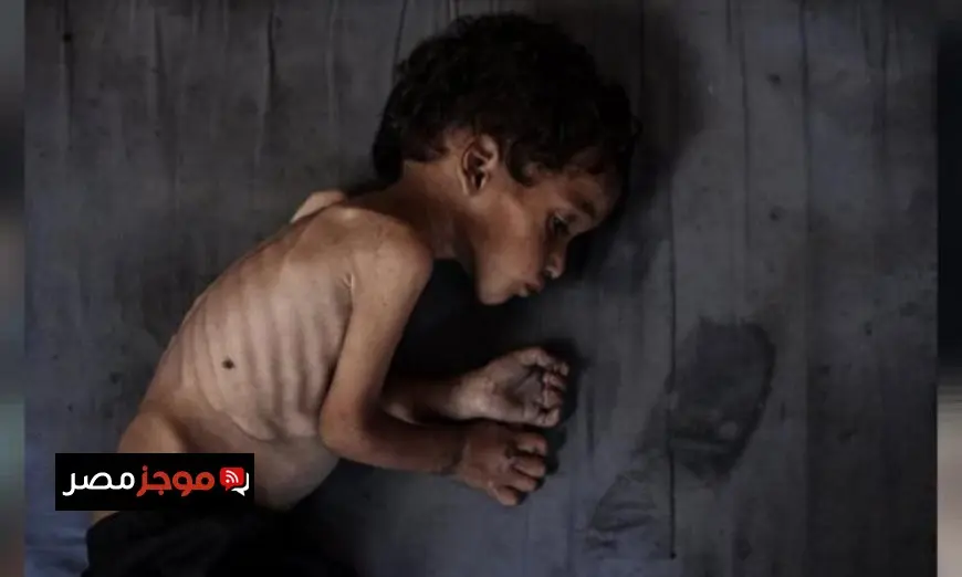 مأساة إنسانية وفاة 5 فلسطينيين من بينهم 3 أطفال بسبب المجاعة في 24 ساعة
