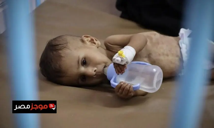 معدل سوء التغذية بين الأطفال في غزة يصل إلى أرقام قياسية وفقاً لليونيسف