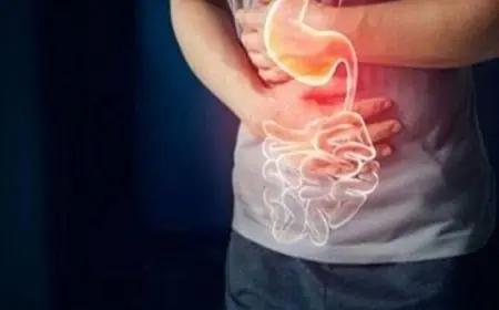 حمية فعالة تخفف التهاب المعدة وتحسن الهضم بنظام غذائي ذكي