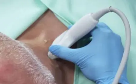 باريس سان جيرمان يواجه توتنهام في قمة مثيرة بدوري أبطال أوروبا