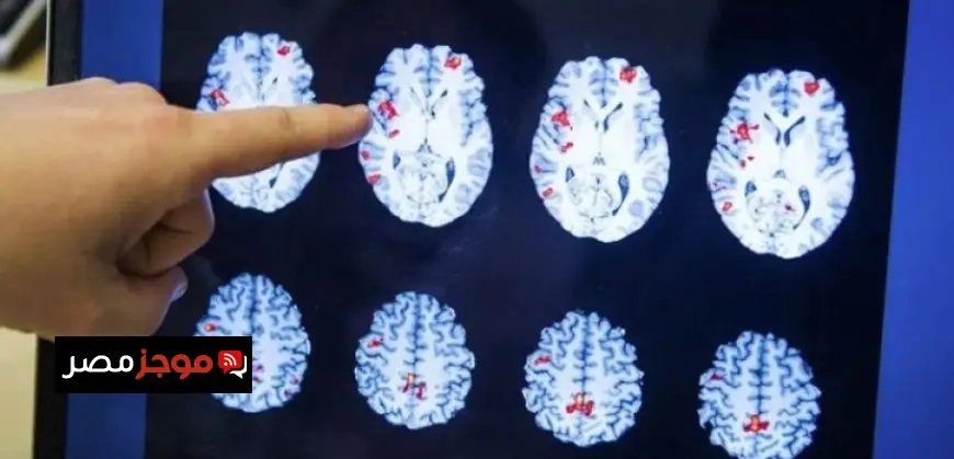 أزمة صامتة تتفاقم في أمريكا مع تزايد ملحوظ في حالات الإعاقات الإدراكية