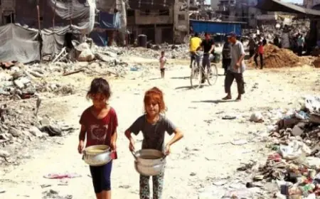 الأونروا تكشف عن معاناة 508 أطفال في غزة بسبب سوء التغذية الحاد