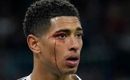 إصابة ريال مدريد المٌفلس بخسارة قاسية بـ9 لاعبين أمام سيلتا فيغو