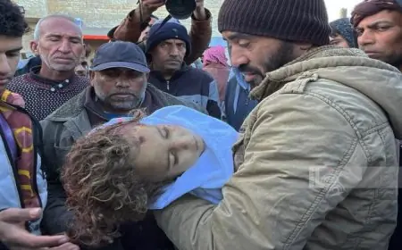 طفل فلسطيني يصاب برصاص الاحتلال الإسرائيلي خلال اقتحام جنوب نابلس