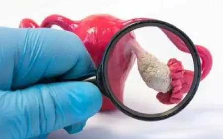 دواء لعلاج سرطان الرئة يفتح آفاق جديدة في مكافحة سرطان المبيض