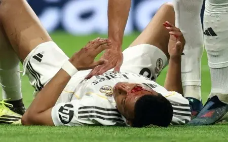 رابطة الدوري الإسباني تواجه اتهامات بإخفاء دماء كيليان مبابي خلال المباريات