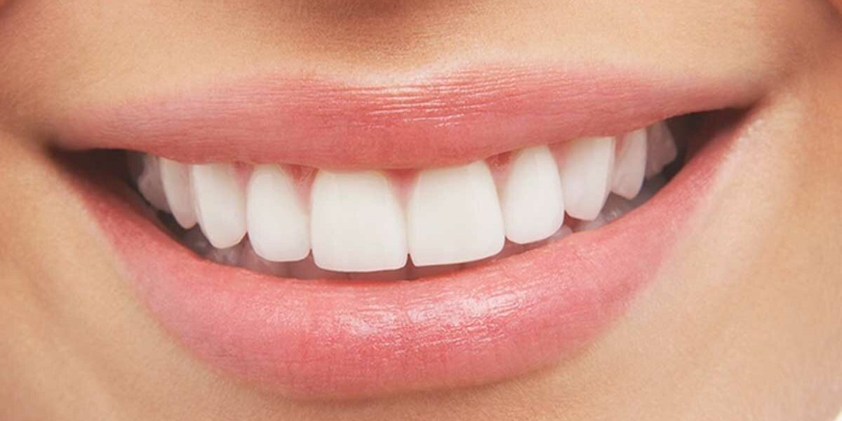 تفسير حلم تركيب الأسنان الأمامية بكافة تأويلاته