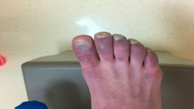 Photo of أسباب تغير لون إصبع القدم الكبير