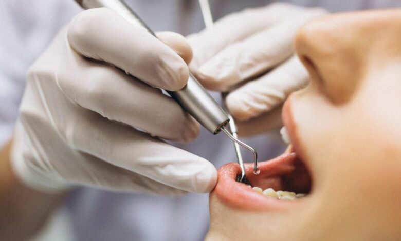 كم راتب طبيب الاسنان أول ما يتخرج